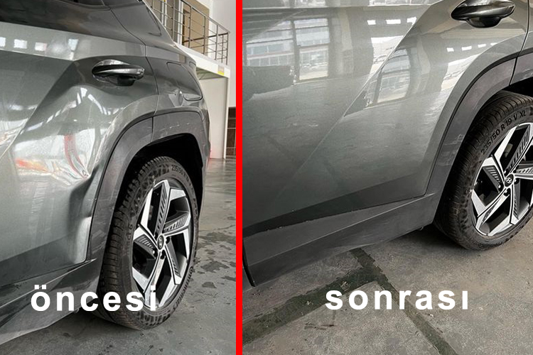 Boyasız Göçük Düzeltme